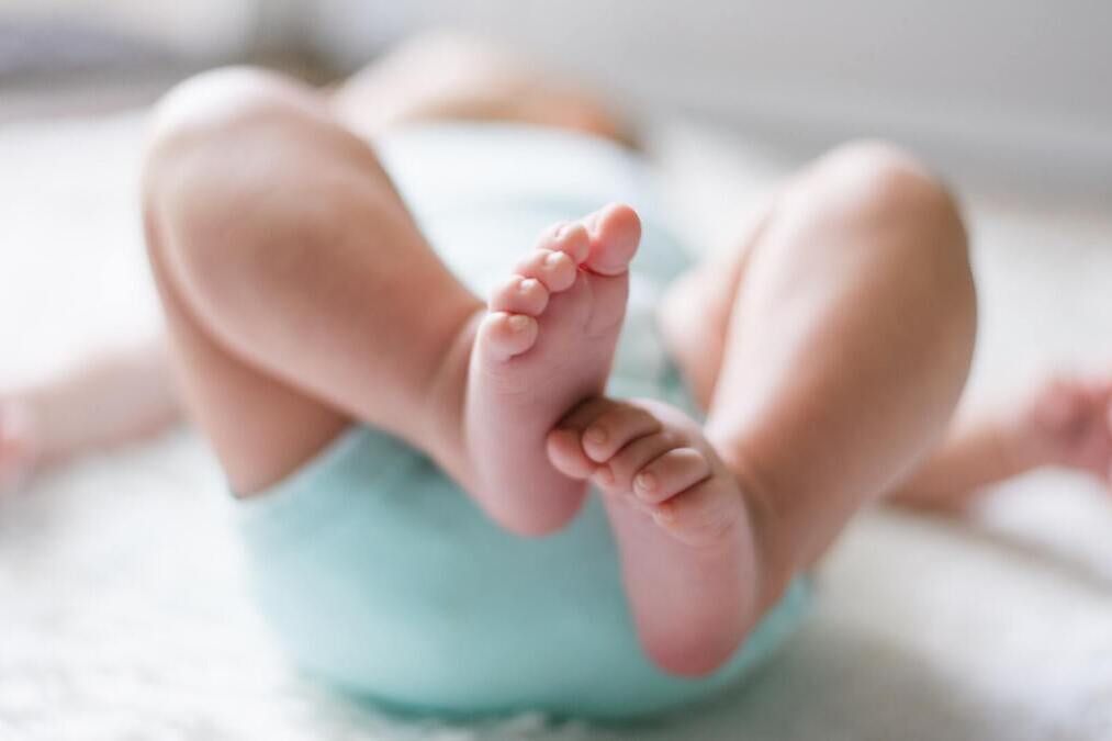 Asymetria ułożeniowa niemowląt | Przyczyny, objawy, terapia
